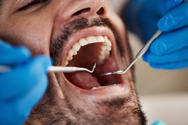 Best Emergency Tooth Extraction  in Gamewell, NC